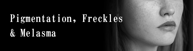 Pigmentation, Freckles & Melasma